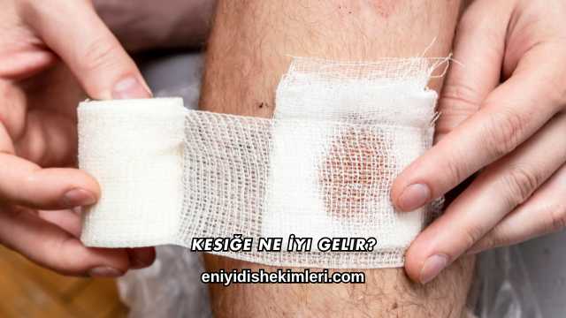 Kesiğe Ne İyi Gelir?