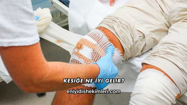 Kesiğe Ne İyi Gelir?