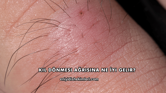 Kıl Dönmesi Ağrısına Ne İyi Gelir?