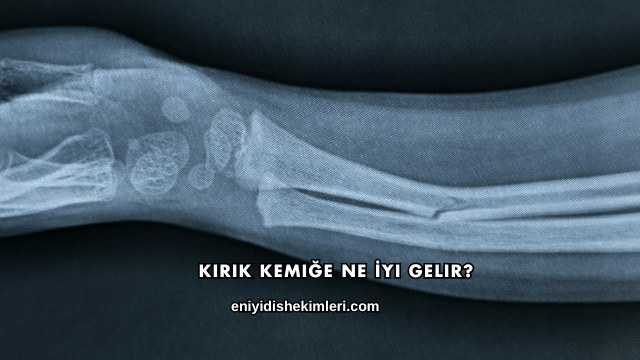 Kırık Kemiğe Ne İyi Gelir?