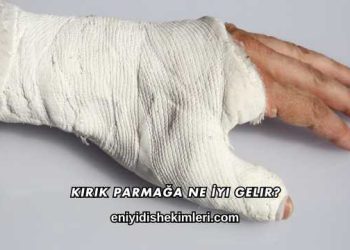 Kırık Parmağa Ne İyi Gelir?