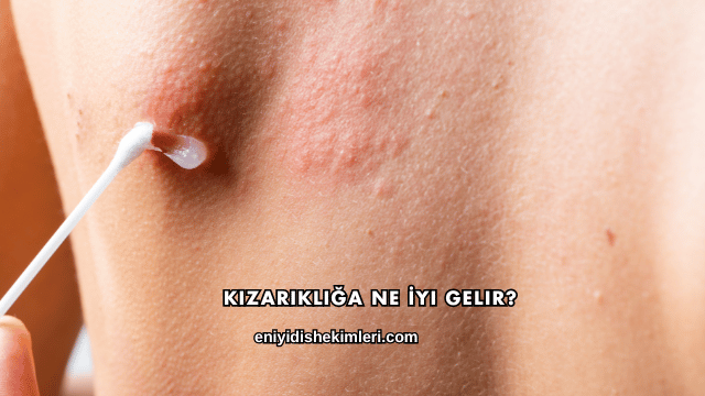 Kızarıklığa Ne İyi Gelir?