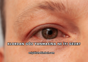 Klordan Göz Yanmasına Ne İyi Gelir?