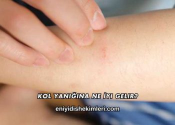 Kol Yanığına Ne İyi Gelir?