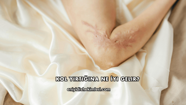 Kol Yırtığına Ne İyi Gelir?