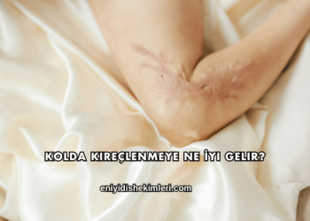 Kolda Kireçlenmeye Ne İyi Gelir?