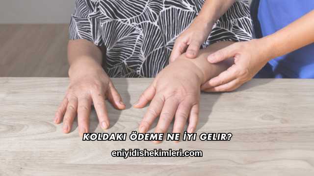 Koldaki Ödeme Ne İyi Gelir?