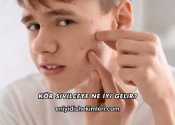 Kör Sivilceye Ne İyi Gelir?