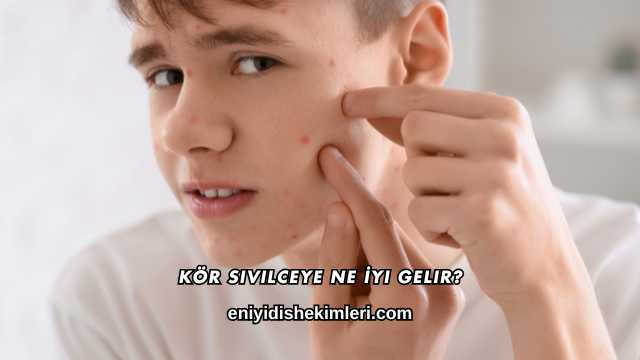 Kör Sivilceye Ne İyi Gelir?