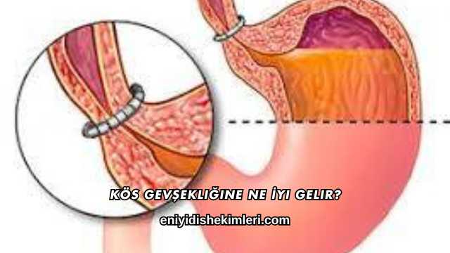 Kös Gevşekliğine Ne İyi Gelir?