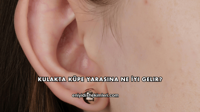 Kulakta Küpe Yarasına Ne İyi Gelir?