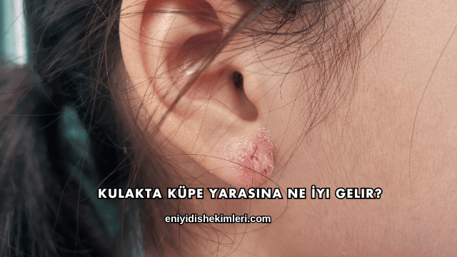 Kulakta Küpe Yarasına Ne İyi Gelir?