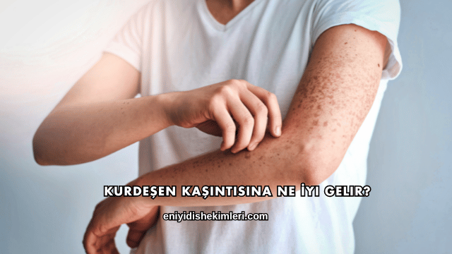 Kurdeşen Kaşıntısına Ne İyi Gelir?