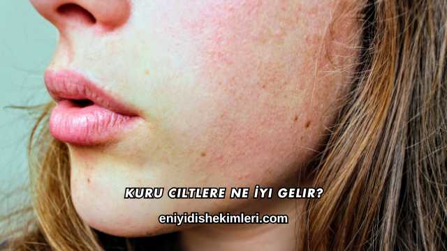 Kuru Ciltlere Ne İyi Gelir?