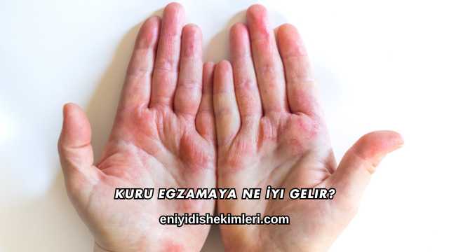 Kuru Egzamaya Ne İyi Gelir?