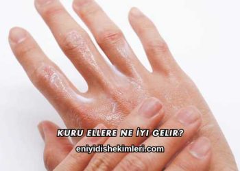 Kuru Ellere Ne İyi Gelir?