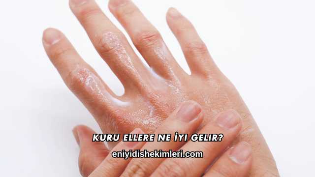 Kuru Ellere Ne İyi Gelir?