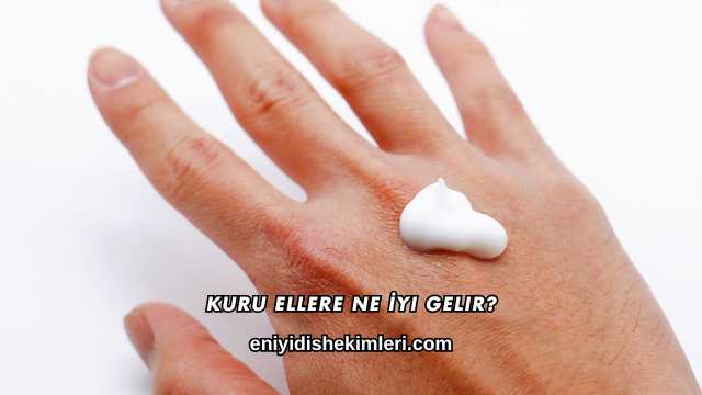 Kuru Ellere Ne İyi Gelir?