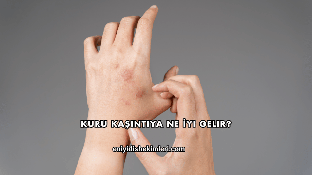 Kuru Kaşıntıya Ne İyi Gelir?