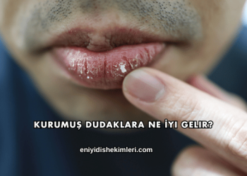 Kurumuş Dudaklara Ne İyi Gelir?