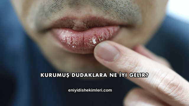Kurumuş Dudaklara Ne İyi Gelir?