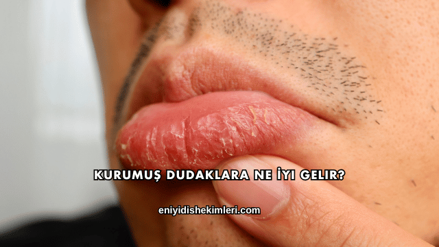 Kurumuş Dudaklara Ne İyi Gelir?