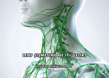 Lenf Şişmesine Ne İyi Gelir?