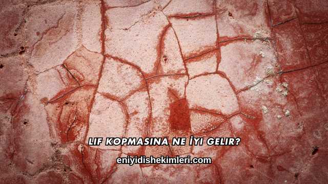 Lif Kopmasına Ne İyi Gelir?