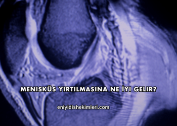 Menisküs Yırtılmasına Ne İyi Gelir?