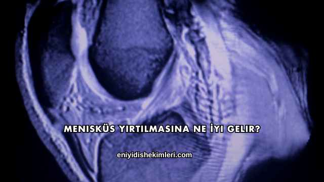 Menisküs Yırtılmasına Ne İyi Gelir?