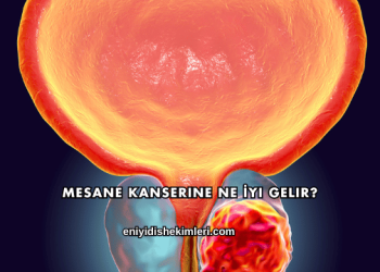 Mesane Kanserine Ne İyi Gelir?
