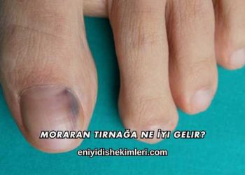 Moraran Tırnağa Ne İyi Gelir?