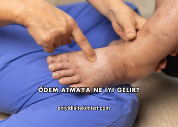Ödem Atmaya Ne İyi Gelir?