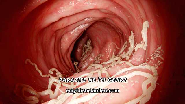 Parazite Ne İyi Gelir?