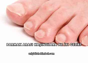 Parmak Arası Kaşıntılara Ne İyi Gelir?