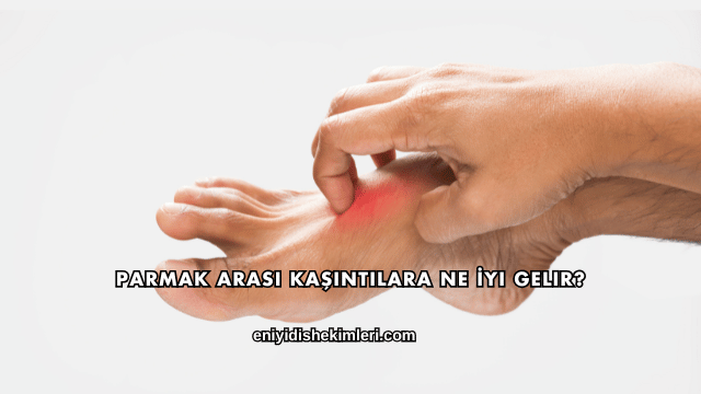 Parmak Arası Kaşıntılara Ne İyi Gelir?