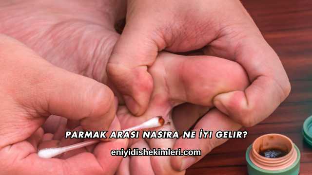 Parmak Arası Nasıra Ne İyi Gelir?