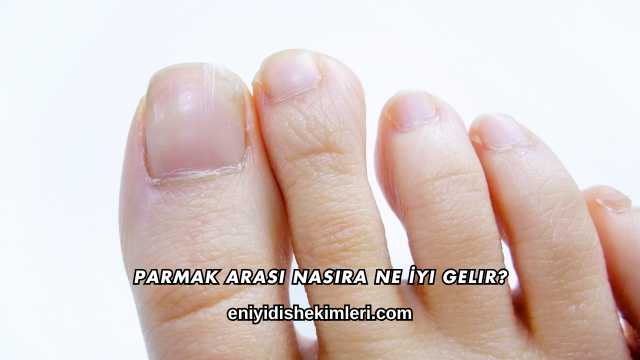 Parmak Arası Nasıra Ne İyi Gelir?