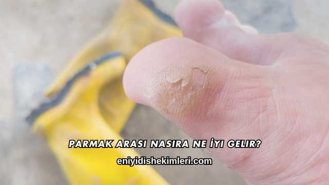 Parmak Arası Nasıra Ne İyi Gelir?