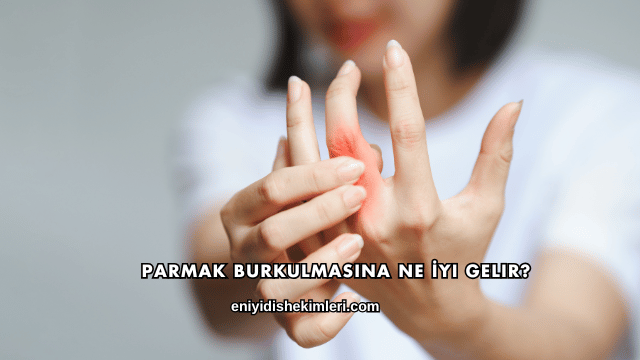 Parmak Burkulmasına Ne İyi Gelir?