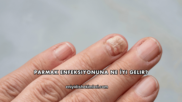 Parmak Enfeksiyonuna Ne İyi Gelir?