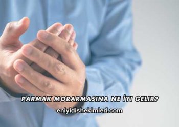 Parmak Morarmasına Ne İyi Gelir?