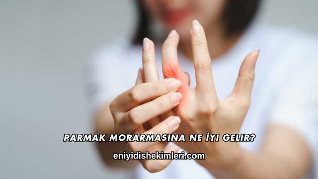 Parmak Morarmasına Ne İyi Gelir?