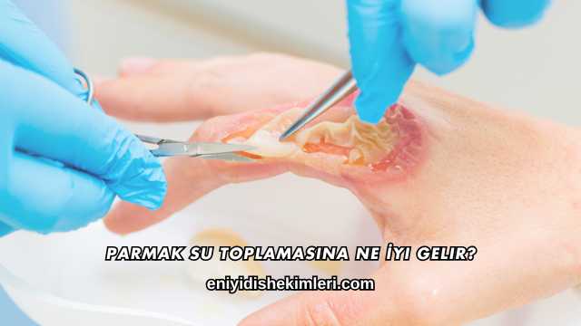 Parmak Su Toplamasına Ne İyi Gelir?