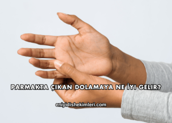 Parmakta Çıkan Dolamaya Ne İyi Gelir?