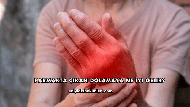 Parmakta Çıkan Dolamaya Ne İyi Gelir?