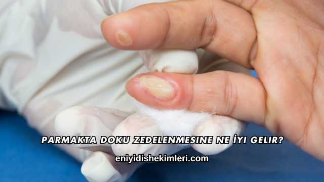 Parmakta Doku Zedelenmesine Ne İyi Gelir?