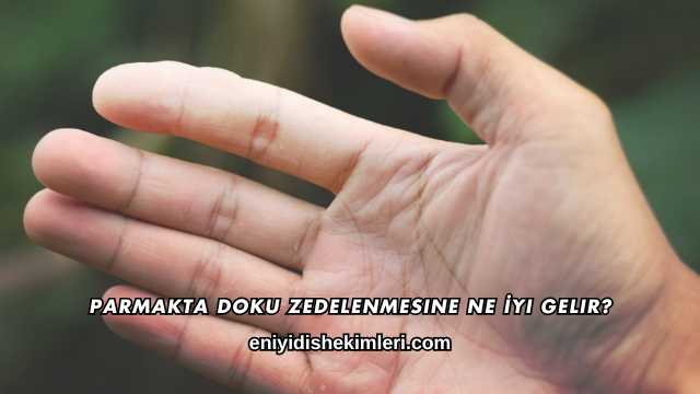 Parmakta Doku Zedelenmesine Ne İyi Gelir?