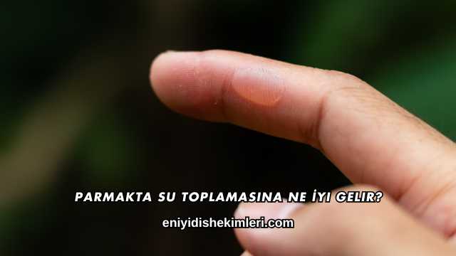 Parmakta Su Toplamasına Ne İyi Gelir?