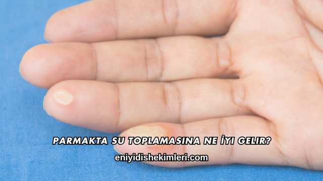 Parmakta Su Toplamasına Ne İyi Gelir?